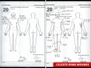Did D4vd Bought Chainsaws After Killing Celeste Rivas? Inside The Chilling Prosecutor Claims