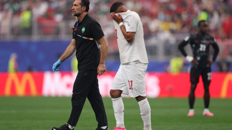 Heartbreaking for Morocco star Ismael Saibari, leaving the pitch against Canada due to hamstring injury