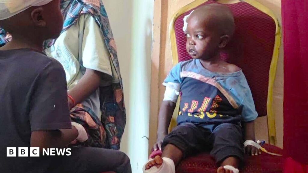 BBC Exposes RSF Attacks on Sudan Hospitals, UN Says War Crimes May Be Underway – 2026 Investigation